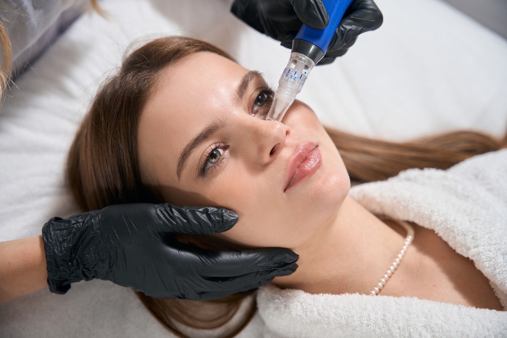 A woman undergoing microneedling treatment, with a close-up on the procedure as a skincare professional gently uses a microneedling device on her face.