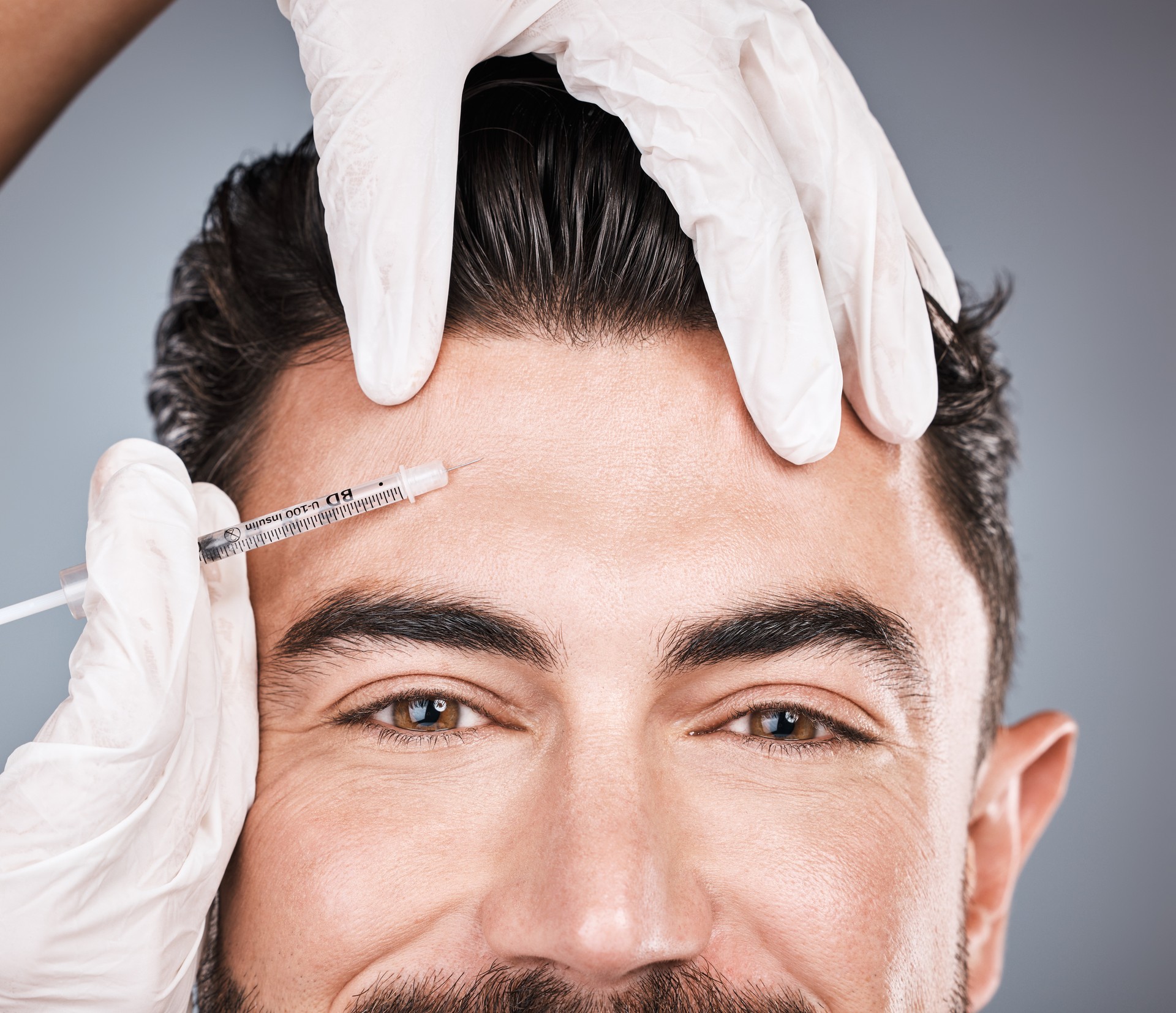 Close-up of a Botox syringe ready for injection. A close-up view of a syringe filled with Botox, prepared for injection to enhance facial aesthetics.